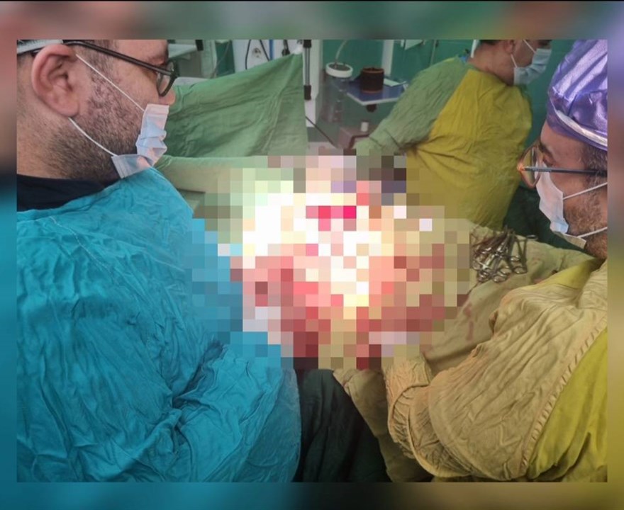 نجات جان یک جوان ۱۸ ساله پس از چاقوخوردگی شدید در قفسه سینه